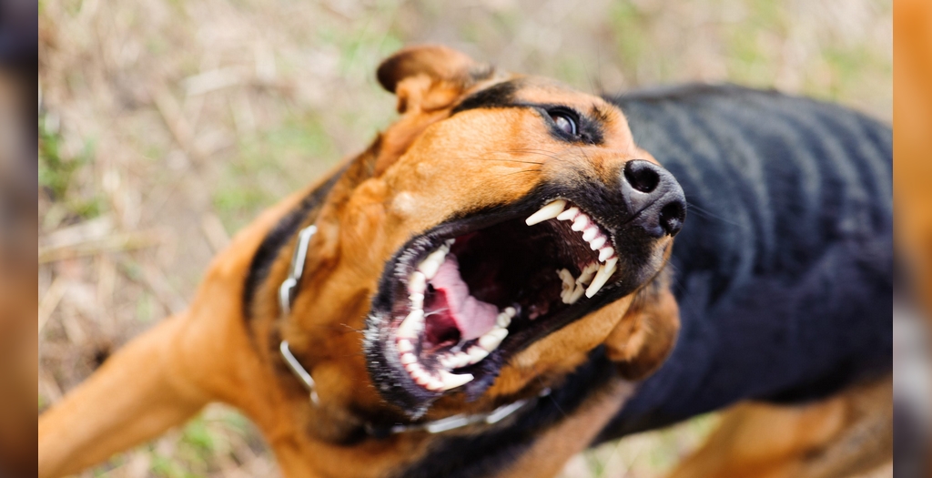 12 Year Old Girl Gets Bitten By A Rottweiler Dog In Chennai